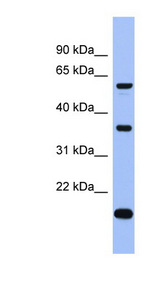LARP6 / ACHN Antibody - LARP6 antibody Western blot of ACHN lysate. This image was taken for the unconjugated form of this product. Other forms have not been tested.