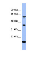 LARP6 / ACHN Antibody - LARP6 antibody Western blot of ACHN lysate. This image was taken for the unconjugated form of this product. Other forms have not been tested.