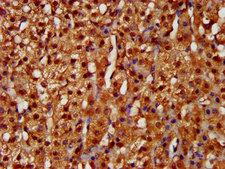 LARP6 / ACHN Antibody - Immunohistochemistry image at a dilution of 1:200 and staining in paraffin-embedded human adrenal gland tissue performed on a Leica BondTM system. After dewaxing and hydration, antigen retrieval was mediated by high pressure in a citrate buffer (pH 6.0) . Section was blocked with 10% normal goat serum 30min at RT. Then primary antibody (1% BSA) was incubated at 4 °C overnight. The primary is detected by a biotinylated secondary antibody and visualized using an HRP conjugated SP system.