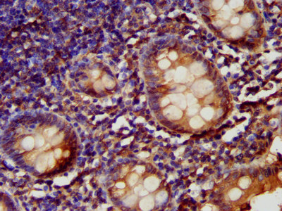 LARP6 / ACHN Antibody - Immunohistochemistry image at a dilution of 1:200 and staining in paraffin-embedded human appendix tissue performed on a Leica BondTM system. After dewaxing and hydration, antigen retrieval was mediated by high pressure in a citrate buffer (pH 6.0) . Section was blocked with 10% normal goat serum 30min at RT. Then primary antibody (1% BSA) was incubated at 4 °C overnight. The primary is detected by a biotinylated secondary antibody and visualized using an HRP conjugated SP system.