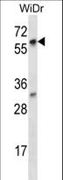 LARP7 Antibody - LARP7 Antibody western blot of WiDr cell line lysates (35 ug/lane). The LARP7 antibody detected the LARP7 protein (arrow).