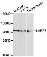 LARP7 Antibody - Western blot analysis of extracts of various cell lines, using LARP7 antibody at 1:3000 dilution. The secondary antibody used was an HRP Goat Anti-Rabbit IgG (H+L) at 1:10000 dilution. Lysates were loaded 25ug per lane and 3% nonfat dry milk in TBST was used for blocking. An ECL Kit was used for detection and the exposure time was 90s.