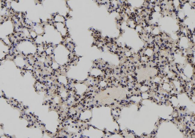 LARP7 Antibody - 1:100 staining mouse lung tissue by IHC-P. The sample was formaldehyde fixed and a heat mediated antigen retrieval step in citrate buffer was performed. The sample was then blocked and incubated with the antibody for 1.5 hours at 22°C. An HRP conjugated goat anti-rabbit antibody was used as the secondary.