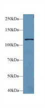 LARS / Leucyl-TRNA Synthetase Antibody