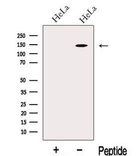 LARS / Leucyl-TRNA Synthetase Antibody - Western blot analysis of extracts of HeLa cells using LARS antibody. The lane on the left was treated with blocking peptide.