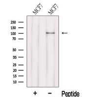 LARS2 / LEURS1 Antibody - Western blot analysis of extracts of MCF-7 cells using LARS2 antibody. The lane on the left was treated with blocking peptide.