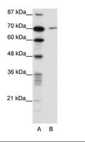 LAS1L Antibody - A: Marker, B: HepG2 Cell Lysate.  This image was taken for the unconjugated form of this product. Other forms have not been tested.