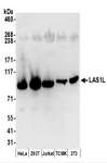 LAS1L Antibody - Detection of Human and Mouse LAS1L by Western Blot. Samples: Whole cell lysate (50 ug) prepared using NETN buffer from HeLa, 293T, Jurkat, mouse TCMK-1, and mouse NIH3T3 cells. Antibodies: Affinity purified rabbit anti-LAS1L antibody used for WB at 0.1 ug/ml. Detection: Chemiluminescence with an exposure time of 30 seconds.