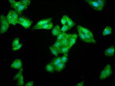 LAS1L Antibody - Immunofluorescence staining of HepG2 cells at a dilution of 1:266, counter-stained with DAPI. The cells were fixed in 4% formaldehyde, permeabilized using 0.2% Triton X-100 and blocked in 10% normal Goat Serum. The cells were then incubated with the antibody overnight at 4 °C.The secondary antibody was Alexa Fluor 488-congugated AffiniPure Goat Anti-Rabbit IgG (H+L) .