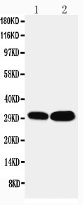 LASP1 Antibody - LASP1 antibody Western blot. Lane 1: HELA Cell Lysate. Lane 2: MCF-7 Cell Lysate.