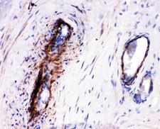 LASP1 Antibody - LASP1 antibody IHC-paraffin: Human Placenta Tissue.