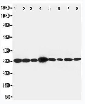 LASP1 Antibody - WB of LASP1 antibody. All lanes: Anti-LASP1 at 0.5ug/ml. Lane 1: Rat Liver Tissue Lysate at 40ug. Lane 2: Rat Spleen Tissue Lysate at 40ug. Lane 3: Rat Intestine Tissue Lysate at 40ug. Lane 4: JURKAT Whole Cell Lysate at 40ug. Lane 5: MCF-7 Whole Cell Lysate at 40ug. Lane 6: A431 Whole Cell Lysate at 40ug. Lane 7: HELA Whole Cell Lysate at 40ug. Lane 8: 293T Whole Cell Lysate at 40ug. Predicted bind size: 30KD. Observed bind size: 30KD.