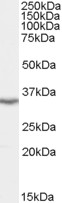 LASP1 Antibody - Antibody staining (0.1 ug/ml) of Human Brain (Cerebellum) extracts (RIPA buffer, 35 ug total protein per lane). Primary incubated for 1 hour. Detected by Western blot of chemiluminescence.