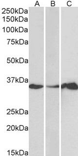 LASP1 Antibody - Goat Anti-LASP1 (N Terminus) Antibody (1µg/ml) staining of Human Cerebellum (A), Colon (B) and Duodenum (C) lysate (35µg protein in RIPA buffer). Primary incubation was 1 hour. Detected by chemiluminescencence