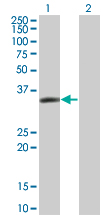 LASP1 Antibody - Western Blot analysis of LASP1 expression in transfected 293T cell line by LASP1 monoclonal antibody (M05), clone 4F5.Lane 1: LASP1 transfected lysate(29.7 KDa).Lane 2: Non-transfected lysate.