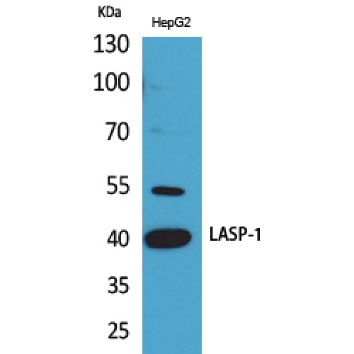 LASP1 Antibody - Western blot of LASP-1 antibody