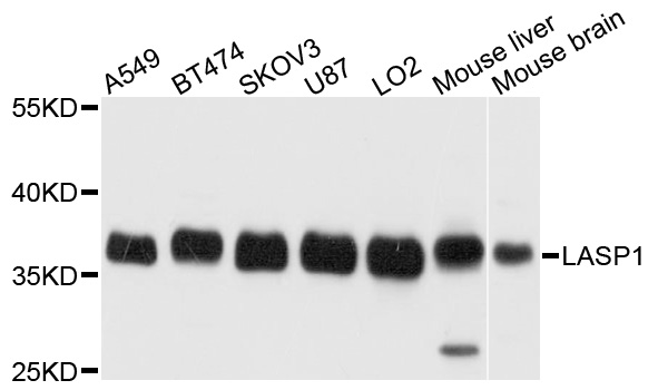 LASP1 Antibody - Western blot analysis of extracts of MCF7 cells.