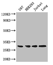 LASP1 Antibody - Positive WB detected in:U87 whole cell lysate,HEK293 whole cell lysate,Jurkat whole cell lysate,Mouse lung tissue;All lanes: LASP1 antibody at 4ug/ml;Secondary;Goat polyclonal to rabbit IgG at 1/50000 dilution;Predicted band size: 30,37,24 kDa;Observed band size: 30 kDa;