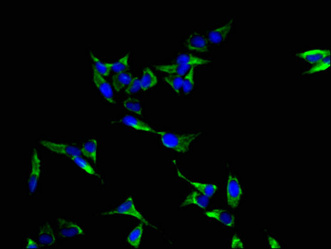 LASP1 Antibody - Immunofluorescent analysis of Hela cells using LASP1 Antibody at a dilution of 1:100 and Alexa Fluor 488-congugated AffiniPure Goat Anti-Rabbit IgG(H+L)