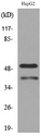 LASP1 Antibody - Western blot analysis of extracts from HepG2 cells, using LASP1 Antibody.