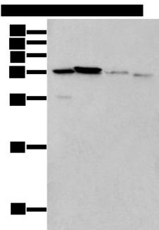 LASP1 Antibody - Western blot analysis of 293T cell Mouse brain tissue and Human kidney tissue lysates  using LASP1 Polyclonal Antibody at dilution of 1:350