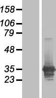 LASP1 Protein - Western validation with an anti-DDK antibody * L: Control HEK293 lysate R: Over-expression lysate