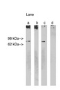 LASS1 Antibody - Western blot of Lass 1 at 5 ug/ml on Human Brain lysate 14 ug/lane. Lane A] antibody alone, Lane B] antibody with 45 ug peptide, Lane C] antibody with nonspecific peptide, D]conjugate alone. Visualized using Pierce West Femto substrate system. Anti Rabbit secondary used at 1:3.5K dilution. Exposure for 5 minutes