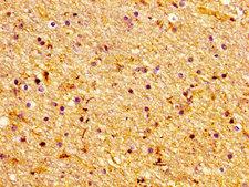 LASS1 Antibody - Immunohistochemistry image of paraffin-embedded human brain tissue at a dilution of 1:100