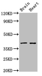 LASS1 Antibody - Positive Western Blot detected in Rat brain tissue, Rat heart tissue. All lanes: CERS1 antibody at 3 µg/ml Secondary Goat polyclonal to rabbit IgG at 1/50000 dilution. Predicted band size: 40, 38 KDa. Observed band size: 40 KDa