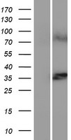 LASS1 Protein - Western validation with an anti-DDK antibody * L: Control HEK293 lysate R: Over-expression lysate
