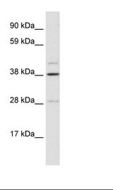 LASS3 Antibody - Fetal Liver Lysate.  This image was taken for the unconjugated form of this product. Other forms have not been tested.