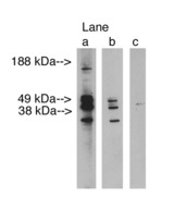 LASS3 Antibody - Western blot of LAG1 longevity assurance homolog 3 at 2.5 ug/ml on human testis lysate 14 ug/lane. Lane A] antibody alone, Lane B] antibody blocked with 40 ug blocking peptide. Lane C] conjugate alone. Visualized using Pierce West Femto substrate system. Anti Rabbit secondary used at dilution used 1:3.5K. Exposure for 3 minutes