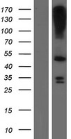 LASS3 Protein - Western validation with an anti-DDK antibody * L: Control HEK293 lysate R: Over-expression lysate