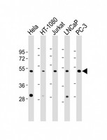 LASS4 Antibody - All lanes: Anti-CERS4 Antibody (N-Term) at 1:2000 dilution. Lane 1: HeLa whole cell lysate. Lane 2: HT-1080 whole cell lysate. Lane 3: Jurkat whole cell lysate. Lane 4: LNCaP whole cell lysate. Lane 5: PC-3 whole cell lysate Lysates/proteins at 20 ug per lane. Secondary Goat Anti-Rabbit IgG, (H+L), Peroxidase conjugated at 1:10000 dilution. Predicted band size: 46 kDa. Blocking/Dilution buffer: 5% NFDM/TBST.