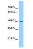 LASS4 Antibody - LASS4 antibody Western Blot of HT1080. Antibody dilution: 1 ug/ml.  This image was taken for the unconjugated form of this product. Other forms have not been tested.