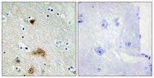 LASS4 Antibody - Immunohistochemistry analysis of paraffin-embedded human brain tissue, using LASS4 Antibody. The picture on the right is blocked with the synthesized peptide.