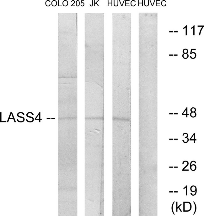 LASS4 Antibody - Western blot analysis of lysates from HUVEC, COLO, and Jurkat cells, using LASS4 Antibody. The lane on the right is blocked with the synthesized peptide.