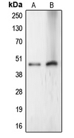 LASS4 Antibody - Western blot analysis of LASS4 expression in HeLa (A); Jurkat (B) whole cell lysates.