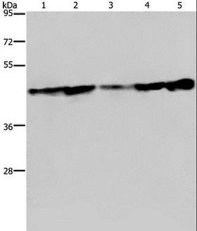 LASS4 Antibody - Western blot analysis of Human fetal liver tissue, HT-29 and HUVEC cell, MCF-7 cell and human hepatocellular carcinoma tissue, using CERS4 Polyclonal Antibody at dilution of 1:300.