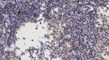 LASS4 Antibody - 1:100 staining human lymph node tissue by IHC-P. The tissue was formaldehyde fixed and a heat mediated antigen retrieval step in citrate buffer was performed. The tissue was then blocked and incubated with the antibody for 1.5 hours at 22°C. An HRP conjugated goat anti-rabbit antibody was used as the secondary.