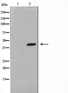 LASS4 Antibody - Western blot analysis on HuvEc cell lysates using LASS4 antibody. The lane on the left is treated with the antigen-specific peptide.