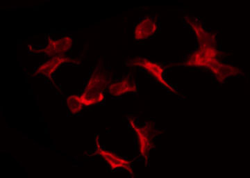 LASS4 Antibody - Staining HuvEc cells by IF/ICC. The samples were fixed with PFA and permeabilized in 0.1% Triton X-100, then blocked in 10% serum for 45 min at 25°C. The primary antibody was diluted at 1:200 and incubated with the sample for 1 hour at 37°C. An Alexa Fluor 594 conjugated goat anti-rabbit IgG (H+L) Ab, diluted at 1/600, was used as the secondary antibody.