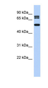 LASS4 Antibody - LASS4 antibody Western blot of SH-SYSY lysate. This image was taken for the unconjugated form of this product. Other forms have not been tested.