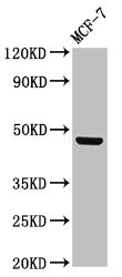 LASS5 Antibody - Positive Western Blot detected in MCF-7 whole cell lysate. All lanes: CERS5 antibody at 3 µg/ml Secondary Goat polyclonal to rabbit IgG at 1/50000 dilution. Predicted band size: 46, 40 KDa. Observed band size: 46 KDa