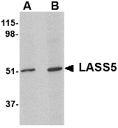 LASS5 Antibody - Western blot of LASS5 in SK-N-SH lysate with LASS5 antibody at (A) 1 and (B) 2 ug/ml