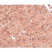 LASS5 Antibody - Immunohistochemistry of LASS5 in mouse brain tissue with LASS5 antibody at 2.5 µg/mL.