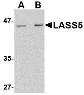 LASS5 Antibody - Western blot of LASS5 in rat brain tissue lysate with LASS5 antibody at (A) 1 and (B) 2 ug/ml.