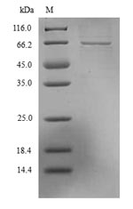 SARS-CoV Nucleoprotein Protein - (Tris-Glycine gel) Discontinuous SDS-PAGE (reduced) with 5% enrichment gel and 15% separation gel.