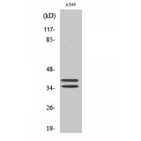 LAT Antibody - Western blot of LAT antibody