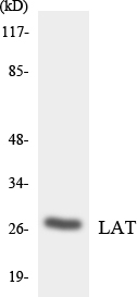 LAT Antibody - Western blot analysis of the lysates from HUVECcells using LAT antibody.